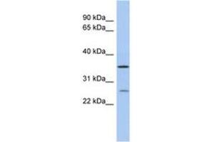 Image no. 1 for anti-Short Chain Dehydrogenase/reductase Family 9C, Member 7 (SDR9C7) (C-Term) antibody (ABIN6743679) (SDR9C7 anticorps  (C-Term))