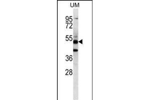 PNLIPRP3 Antibody (N-term) (ABIN656711 and ABIN2845941) western blot analysis in uterus tumor cell line lysates (35 μg/lane). (PNLIPRP3 anticorps  (N-Term))