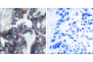 Peptide - +Immunohistochemical analysis of paraffin-embedded human breast carcinoma tissue using Claudin 1 antibody (#C0142). (Claudin 1 anticorps)