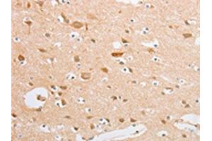 The image on the left is immunohistochemistry of paraffin-embedded Human brain tissue using ABIN7131039(SERPINE2 Antibody) at dilution 1/20, on the right is treated with fusion protein.