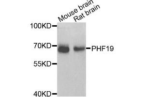 Western blot analysis of extracts of various cells, using PHF19 antibody. (PHF19 anticorps)