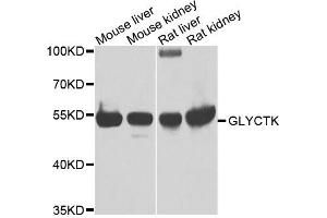 Western blot analysis of extracts of various cells, using GLYCTK antibody. (GLYCTK anticorps)