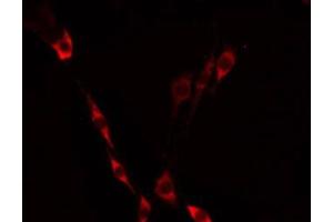 ABIN6275233 staining Hela by IF/ICC. (MRPS21 anticorps  (C-Term))
