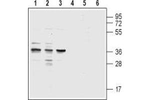 Western blot analysis of acute monocytic leukemia THP-1 (lanes 1 and 4), promyelocytic leukemia HL-60 (lanes 2 and 5) and acute T-cell leukemia Jurkat (lanes 3 and 6) human cell lysates: - 1,2,3. (CysLTR1 anticorps  (3rd Extracellular Loop))