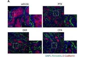 Chemotherapy enriches periostin protein and the mesenchymal cell population in TNBC xenografts.