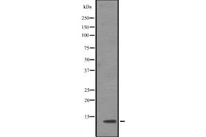 Western blot analysis of TCEB1 expression in Jurkat cell line lysates ,The lane on the left is treated with the antigen-specific peptide. (TCEB1 anticorps  (N-Term))