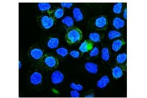 IF analysis of PICALM using anti-PICALM antibody (ABIN7599516). (PICALM anticorps  (AA 1-652))