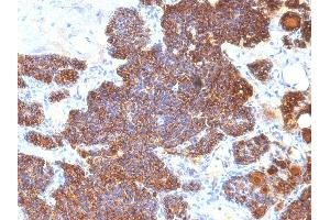 Formalin-fixed, paraffin-embedded human Parathyroid stained with PTH Monoclonal Antibody (PTH/1174). (PTH anticorps  (AA 32-115))