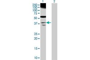 Western Blot analysis of RP2 expression in transfected 293T cell line by RP2 MaxPab polyclonal antibody. (RP2 anticorps  (AA 1-350))