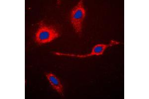 anti-Caspase 3 p17 (Center) antibody