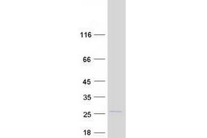 Validation with Western Blot