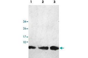 Western blot analysis of human fetal kidney (Lane 1), fetal liver (Lane 2) and fetal heart (Lane 3) lysate with HHLA3 polyclonal antibody  at 1 : 1000 dilution. (HHLA3 anticorps  (AA 1-122))