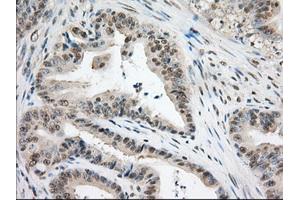 Image no. 10 for anti-Transforming, Acidic Coiled-Coil Containing Protein 3 (TACC3) antibody (ABIN1498097) (TACC3 anticorps)