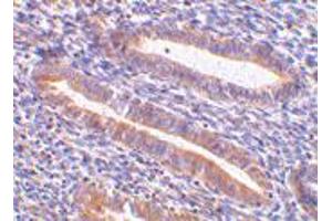 Immunohistochemistry of HAVCR1 in human uterus tissue with HAVCR1 polyclonal antibody  at 10 ug/mL . (HAVCR1 anticorps  (N-Term))