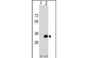 Western blot analysis of DOK5 (arrow) using rabbit polyclonal DOK5 Antibody (N-term) (ABIN1539174 and ABIN2848803).
