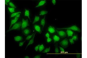Immunofluorescence of monoclonal antibody to RP6-213H19.