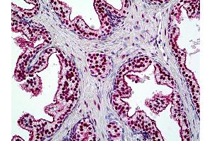 Anti-SMARCA4 / BRG1 antibody IHC of human prostate. (SMARCA4 anticorps  (AA 2-14))
