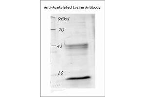Western blot analysis of Mouse Spleen lysates showing detection of Acetylated Lysine protein using Rabbit Anti-Acetylated Lysine Polyclonal Antibody . (Lysine (lys) (acetylated) anticorps (HRP))