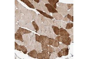 Immunohistochemical staining of human skeletal muscle with SYDE2 polyclonal antibody  shows strong cytoplasmic positivity in subsets of muscle fibers at 1:50-1:200 dilution. (SYDE2 anticorps)