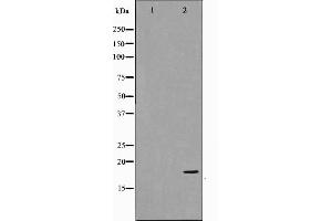 anti-P18 INK antibody