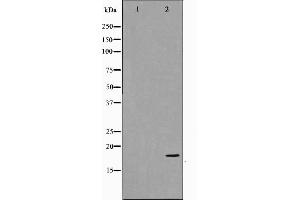 Western blot analysis on COS7 cell lysate using p18 INK Antibody,The lane on the left is treated with the antigen-specific peptide.