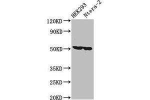 Western Blot Positive WB detected in: HEK293 whole cell lysate, Ntera-2 whole cell lysate All lanes: RUVBL1 antibody at 3. (RUVBL1 anticorps  (AA 101-400))