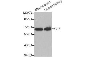 Western blot analysis of extracts of various cell lines, using GLS antibody. (Glutaminase anticorps  (AA 610-669))