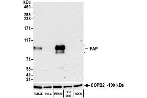 Western Blotting (WB) image for anti-Fibroblast Activation Protein, alpha (FAP) (AA 26-760) antibody (ABIN7453971)