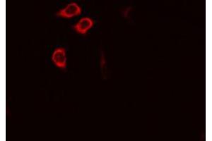 ABIN6274524 staining RAW264. (IARS2 anticorps  (N-Term))