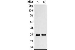 Western blot analysis of PRRX1 expression in NCIH292 (A), NIH3T3 (B) whole cell lysates. (PRRX1 anticorps  (Center))