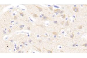 Detection of NFE2L2 in Human Cerebrum Tissue using Polyclonal Antibody to Nuclear Factor, Erythroid Derived 2 Like Protein 2 (NFE2L2)
