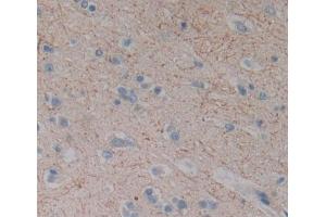 Used in DAB staining on fromalin fixed paraffin- embedded brain tissue (DLG5 anticorps  (AA 1722-1905))