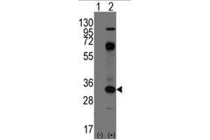 Image no. 1 for anti-CD8 (CD8) (C-Term) antibody (ABIN356888) (CD8 anticorps  (C-Term))