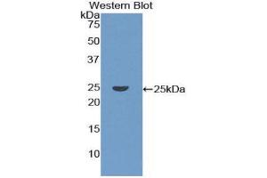 Western Blotting (WB) image for anti-Coronin, Actin Binding Protein, 1A (CORO1A) (AA 7-204) antibody (ABIN1858472) (Coronin 1a anticorps  (AA 7-204))