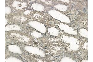 ABIN6263808 and ABIN6272370 at 1/100 staining human normal kidney tissue by IHC-P.
