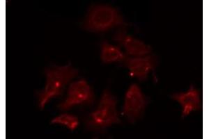 ABIN6266797 staining COLO205 by IF/ICC. (ATF6B anticorps  (Internal Region))