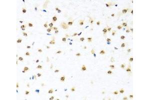 Immunohistochemistry of paraffin-embedded Mouse brain using RAB3IP Polyclonal Antibody at dilution of 1:100 (40x lens). (RAB3IP anticorps)