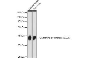 Western blot analysis of extracts of various cell lines, using Glutamine Synthetase (GLUL) antibody (ABIN6130425, ABIN6141161, ABIN6141162 and ABIN7101772) at 1:1000 dilution. (GLUL anticorps  (AA 1-373))