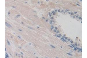 Detection of ITIH1 in Human Prostate Tissue using Polyclonal Antibody to Inter Alpha-Globulin Inhibitor H1 (ITIH1) (ITIH1 anticorps  (AA 507-819))