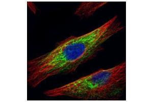 ICC/IF Image Confocal immunofluorescence analysis (Olympus FV10i) of paraformaldehyde-fixed HeLa, using HDAC6, antibody (Green) at 1:500 dilution. (HDAC6 anticorps  (N-Term))