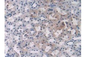 IHC-P analysis of Rat Liver Tissue, with DAB staining. (OAS1 anticorps  (AA 139-358))