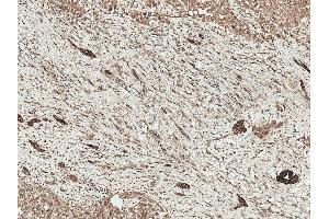 Immunohistochemistry analysis using Rabbit Anti-LRP1 Polyclonal Antibody (ABIN5696062).
