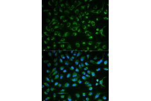 Immunofluorescence analysis of MCF7 cell using NT5E antibody. (CD73 anticorps)