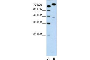 WB Suggested Anti-MCM3 Antibody Titration:  0. (MCM3 anticorps  (C-Term))