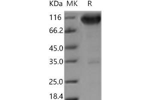 Western Blotting (WB) image for Neurotrophic Tyrosine Kinase, Receptor, Type 1 (NTRK1) (Active) protein (Fc Tag) (ABIN7321091)