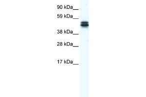 WB Suggested Anti-E130307M08RIK Antibody Titration:  1. (MPND anticorps  (Middle Region))