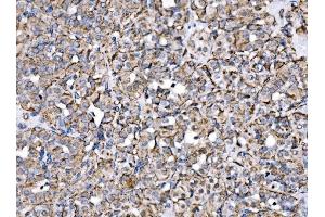 IHC analysis of MPPB/PMPCB using anti-MPPB/PMPCB antibody (ABIN7600758). (PMPCB anticorps  (AA 23-479))