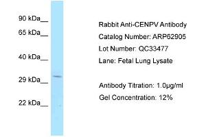Western Blotting (WB) image for anti-Centromere Protein V (CENPV) (C-Term) antibody (ABIN2789289) (CENPV anticorps  (C-Term))