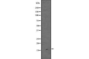 Western blot analysis of ARPC5 using HuvEc whole  lysates.