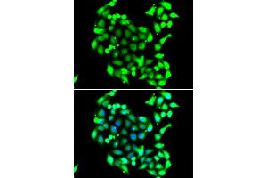 Immunofluorescence analysis of A549 cells using GTF2H3 antibody. (GTF2H3 anticorps  (AA 1-308))